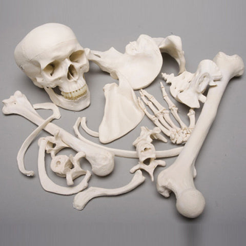 Large Bag of Bones, 2nd Class