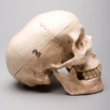 "Harvey" Skull, 2nd Class, Aged Version