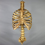 "Harvey" Skeleton Rib Cage & Spine, Life Size, 2nd Class, Aged Version