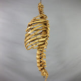 "Harvey" Skeleton Rib Cage & Spine, Life Size, 2nd Class, Aged Version