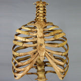 "Harvey" Skeleton Rib Cage & Spine, Life Size, 2nd Class, Aged Version