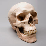 "Harvey" Skull, 2nd Class, Aged Version