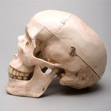 "Harvey" Skull, 2nd Class, Aged Version