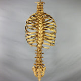 "Harvey" Skeleton Rib Cage & Spine, Life Size, 2nd Class, Aged Version