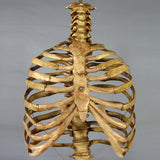 "Harvey" Skeleton Rib Cage & Spine, Life Size, 2nd Class, Aged Version